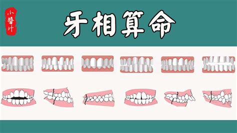 缺牙運勢